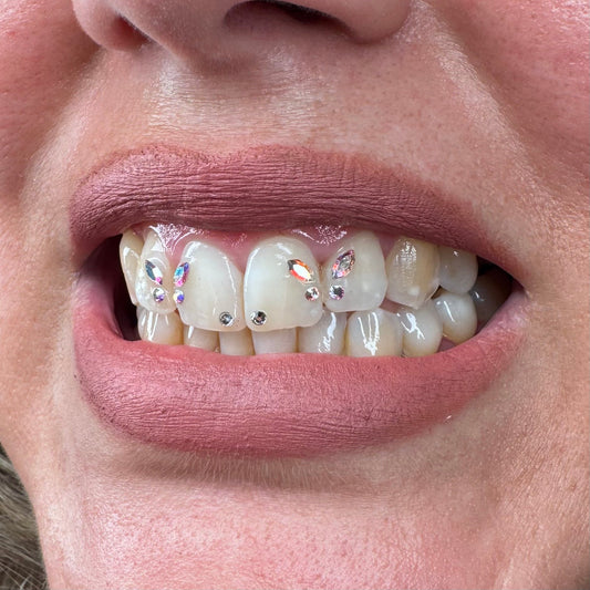 Gemas dentales Barcelona